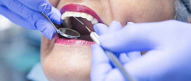 Best Dentist for Tooth Abscess  in Short Hills, NJ